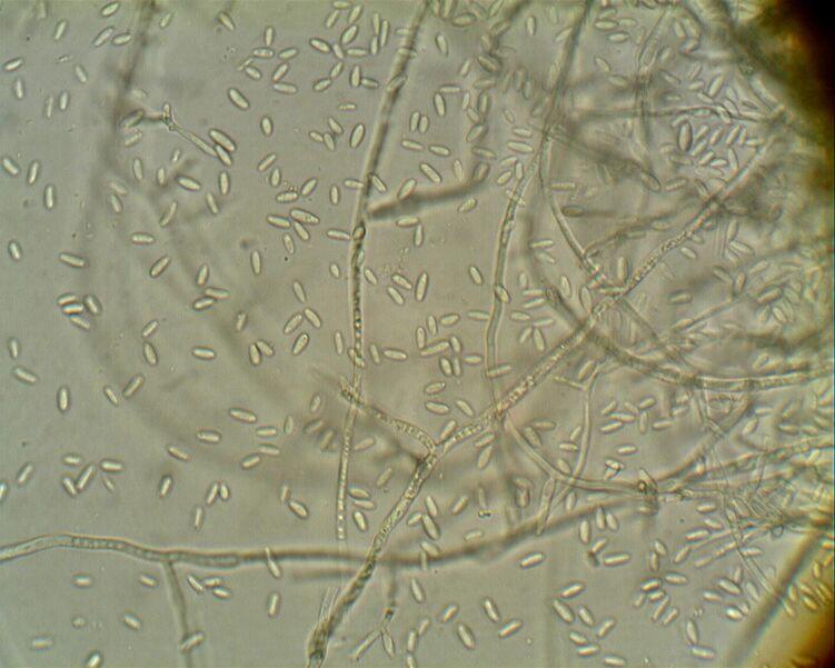 fusariose microscope